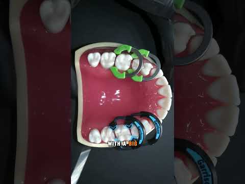 The Quad Matrix System from Garrison Dental Solutions