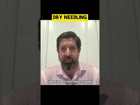Dry Needling